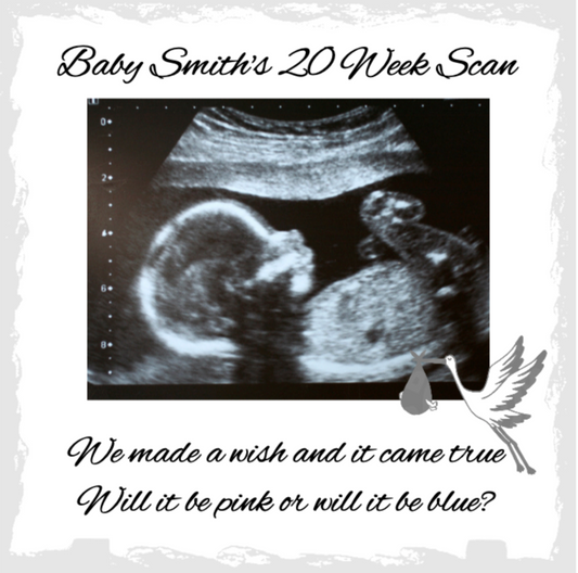 Personalised Photo Slate, Baby Scan, Baby Announcement, Add Your Picture or Text